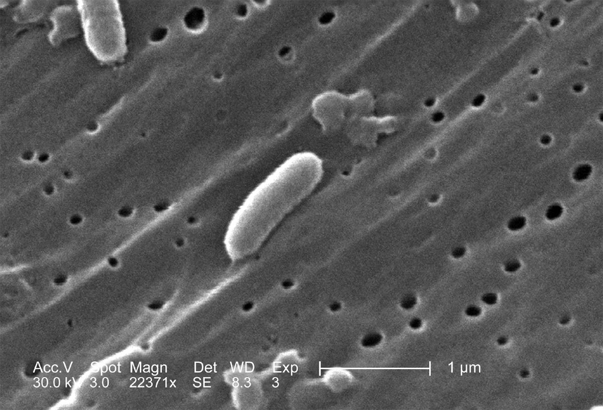 Imagen de microscopio electrónico de barrido de Vibrio cholerae 01 CDC - photo 1