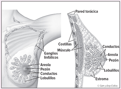 La mayoría de los tipos de cáncer de seno empiezan en las células que revisten - photo 1