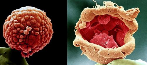 FigX Sumamente prometedora la terapia con Stem-Cells se encuentra todavía en - photo 1